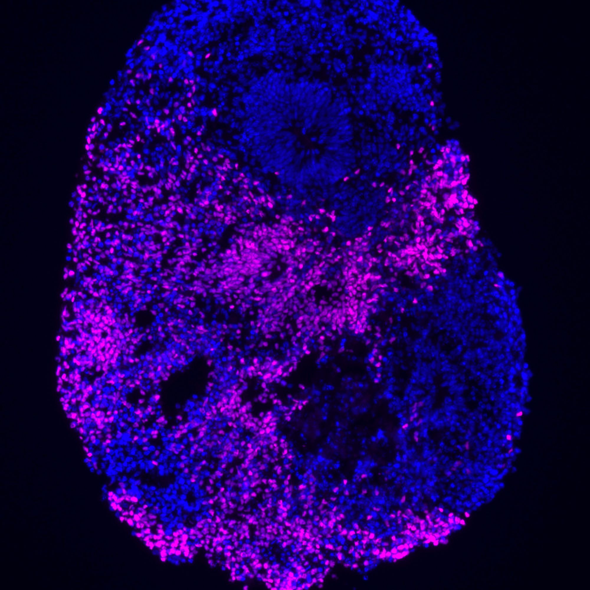 brain organoid